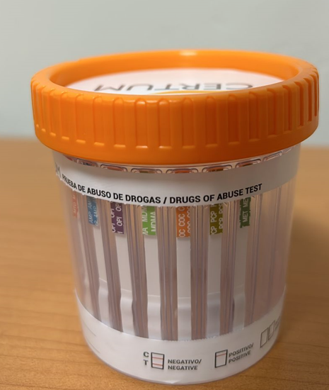 PRUEBA TOXICOLOGICA 2